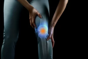 جلوگیری از پیشرفت آرتروز