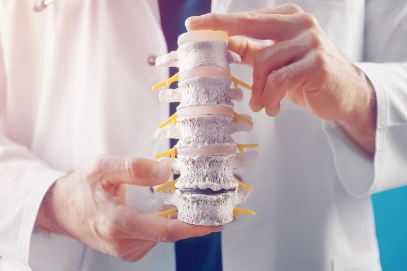 دیسک گردن و بی حسی پا - ستون فقرات