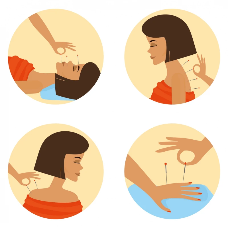 طب سوزنی در درمان دیسک گردن بدون جراحی