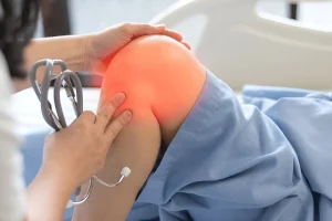 درمان خشکی زانو بعد از جراحی